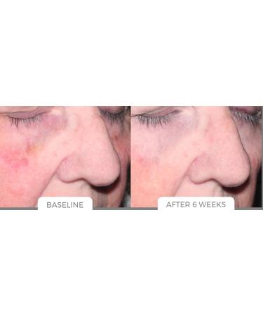 Age Reverse System - Rejuvenate Your Skin & Reverse Aging | Shop Internationally - Buy Online on SooperMarket.com