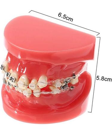 Buy Model Doll-10 Orthodontic Braces for Adults | Ceramic Demonstration Teeth | Mobile Medical Science & Teaching Research - Buy Online on SooperMarket.com