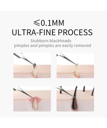 Professional Facial Blackhead Remover Tweezers Precision Extractor Pimple Popper Tool Kit Skin Acne Removal Clip Kit for Whitehead Blemishs Comedones Bend Clamp - Buy Online on SooperMarket.com