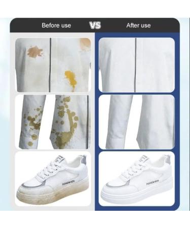 Clothing Stain Removal Wet Wipes Individual Wrapped Cleaning Wipes 20 Pcs/Pack (1box) - Buy Online on SooperMarket.com