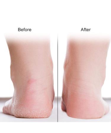 Silicone Socks for Cracked Heels - Moisturizing Heel Protection & Foot Care Tool (S-03#) - Buy Online on SooperMarket.com