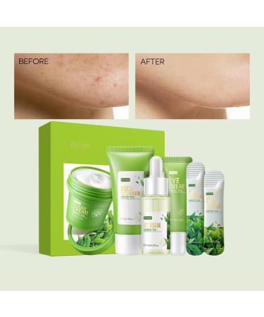 Buy Green Tea Skincare Set - 19-In-1 Gift with Natural Extracts | Cleanser Serum Creams & Masks for Teen Girls - Moisturizing & Nourishing Skin Care - Buy Online on SooperMarket.com