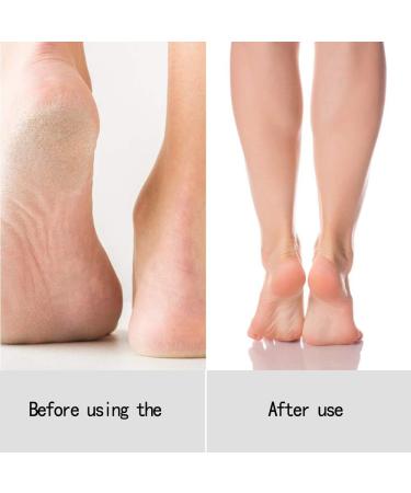 Lanlousy Balnafen Hand Wax Hand Mask Gloves Foot and Foot Mask Exfoliating Moisturizing Hand and Set 1 - Buy Online on SooperMarket.com