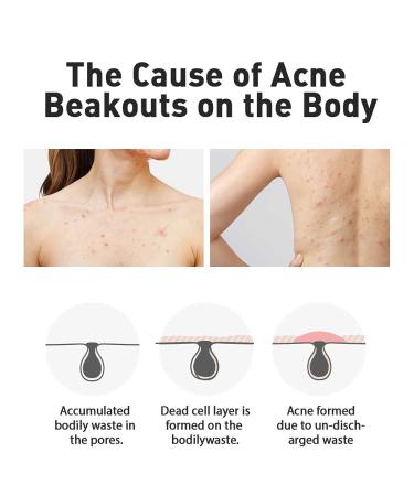 Dashu Daily Acne Relax Body Wash 16.9fl oz - Cooling Acne Treatment - Buy Online on SooperMarket.com