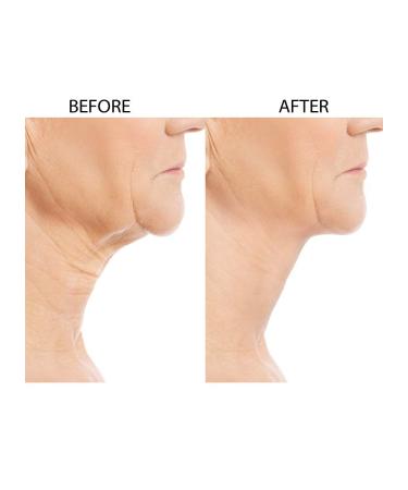 Crepe Be Gone Firming Neck Cream 3oz - Pack of 1, One Size - Buy Online on SooperMarket.com