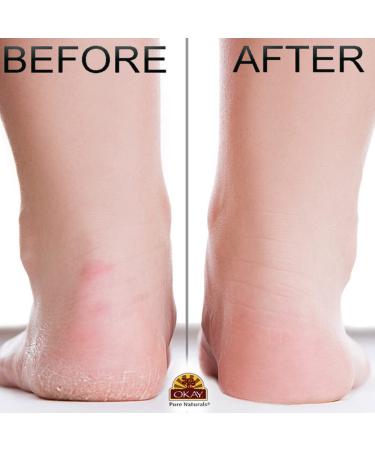 OKAY Papaya Foot Scrub 6 oz - Exfoliating and Moisturizing Foot Care Solution - Buy Online on SooperMarket.com