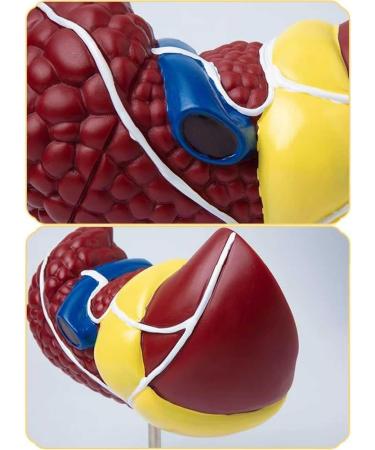 Teaching Model Human Liver Educational Model with Base and Clear Texture and Pathological Features Liver Cirrhosis Model for Medical School Study and Research - Buy Online on SooperMarket.com