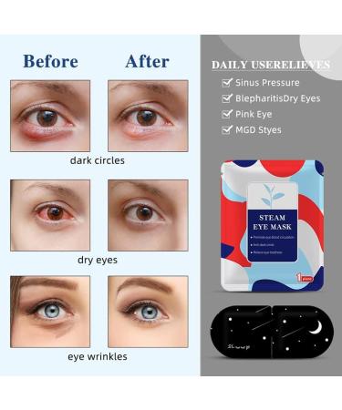 ONIYEA 15-Pack Unscented Steam Eye Masks for Dry Eyes Relief and Puffy Eyes - Disposable Moist Heating Compress Pads for Sleep - SPA Warm Eye Masks for Eye Fatigue - Buy Online on SooperMarket.com
