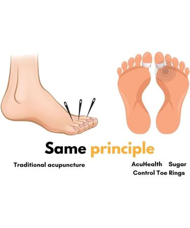 AcuHealth Sugar Control Toe Rings Therapeutic Magnetic Toe Ring Magnetic Therapy Ring Adjustable Pain Relief for Arthritis Blood Flow and Carpal Tunnel Lymphatic Drainage Therapeutic (Color : 5pa 5pairs - Buy Online on SooperMarket.com