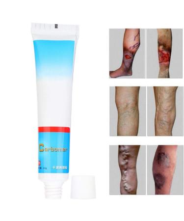 Varicose Vein Treatment Cream - Reduce Inflammation, Improve Circulation | Vein Lotion for Legs & Body - Buy Online on SooperMarket.com