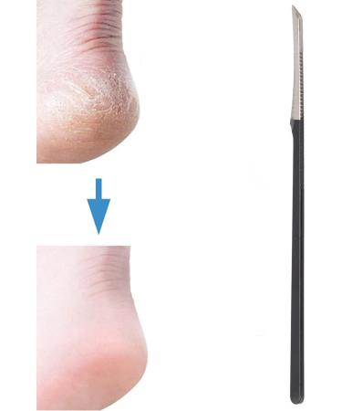 Entatial Calluses Scraping Knife Dead Skin Removal Pedicure Knife Ergonomic Stainless Steel for Pedicure Scraping Dead Skin Relieve Itchn EntatialBIAJS2M - Buy Online on SooperMarket.com