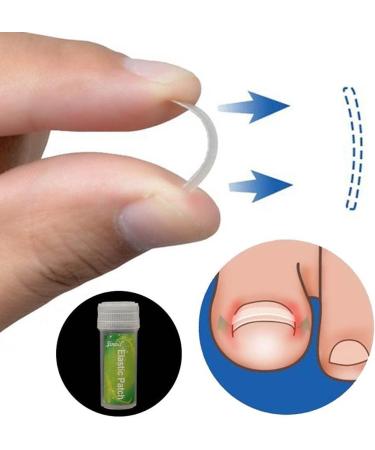Toenail Tool 6 in 1 Ingrown Toe Nail Fixer Pedicure Toenail Recover Nail Foot Care Kit Ingrown Toenail Corrector for Men Women(24pcs) - Buy Online on SooperMarket.com