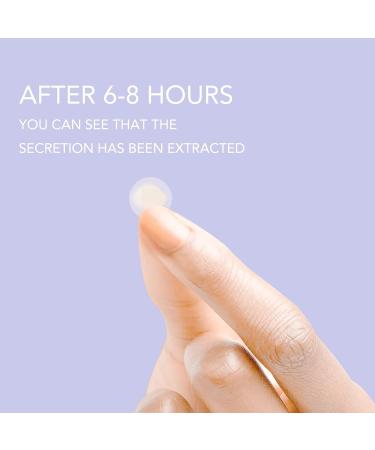 Aliobio Hydrocolloid Pimple Patches - 216 Invisible Acne Stickers - Purple (6 Sheets) - Buy Online on SooperMarket.com