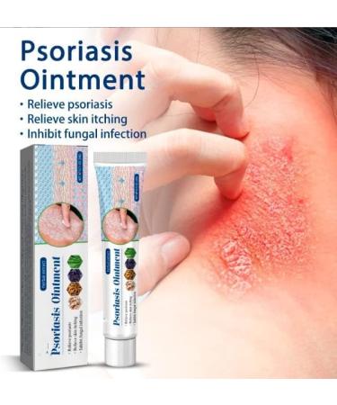 Eczema & Psoriasis Cream - Natural Relief for Dry, Itchy Skin | Scalp Rash Redness Acne - Buy Online on SooperMarket.com