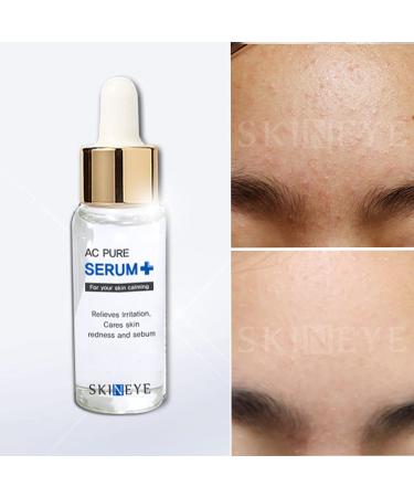 Buy AC Pure Serum | Best International Shipping | High-Quality Skincare - Buy Online on SooperMarket.com