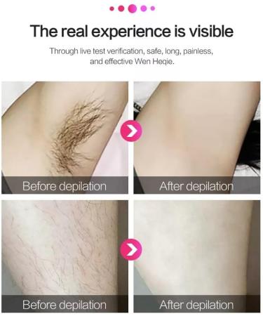 Laser Hair Removal for Women - Permanent Painless IPL Device with 999,999 Flashes, 5 Energy Levels, 2 Modes - Ideal for Face, Body, Bikini - Deep Green - Buy Online on SooperMarket.com