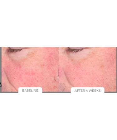 Age Reverse System - Rejuvenate Your Skin & Reverse Aging | Shop Internationally - Buy Online on SooperMarket.com