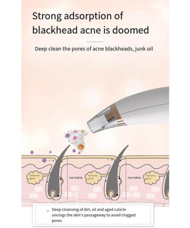 MRNHA Electric Blackhead Remover Face Pimple Extraction Deep Spots Pore Acne Removal Cleaner Cleanser - Buy Online on SooperMarket.com