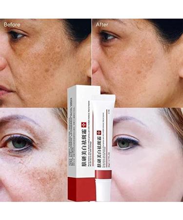 Dark Spot Remover Cream for Face, Body & Sensitive Areas - With Alpha Arbutin, Niacinamide, Collagen, Vitamin E - Powerful Age Spot Corrector - Buy Online on SooperMarket.com