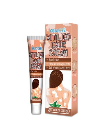 Vitiligo Cream Natural Effective Vitiligo Treatment for Reduce White Spots and Improve Skin Pigmentation