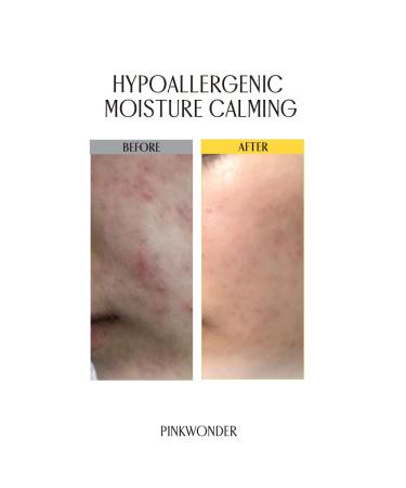 Buy Tamanu Hero Calming Gel 5.07oz | Organic Cooling & Soothing Relief for Skin & Sunburn | Alcohol-Free Korean Skincare - Buy Online on SooperMarket.com