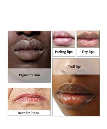 H.D.S.N. 2PCS Pink Lip Lightening Bleaching Oil for Moisturizing and Removing Dark Smoke Lips - Buy Online on SooperMarket.com