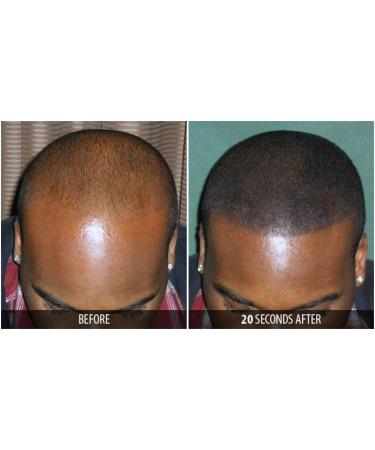 Dr. Yates MD Keratin Fiber Hair Enhancer - Dark Brown | Instantly Thicker Hair Solution - Buy Online on SooperMarket.com