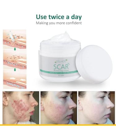 30g Scar Repair Cream | Reduces Stretch Marks, Burns & Acne Scars | Skin Smoothing Treatment - Buy Online on SooperMarket.com