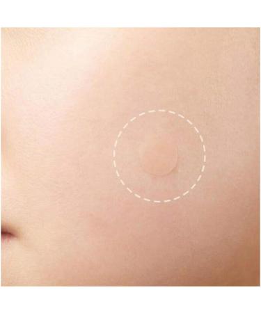36 Acne Pimple Spot Zit Patches Face Treatment Stickers Pimple Cover Invisible Hydrocolloid Absorbing Cover Up Covering Healing Patch for Concealer Blemish Care + Free Blackhead Zit Remover Tool - Buy Online on SooperMarket.com