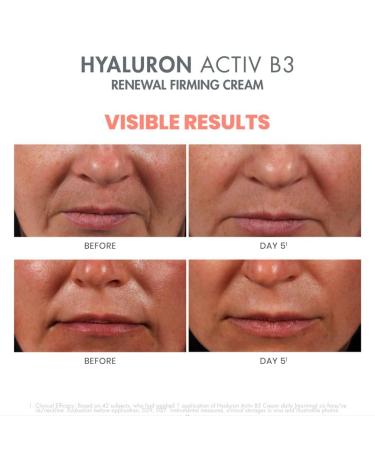 Buy Avene Eau Thermale Hyaluron Activ B3 Renewal Firming Cream Hydrating Anti-Aging Moisturizer for All Skin Types | International Shipping - Buy Online on SooperMarket.com