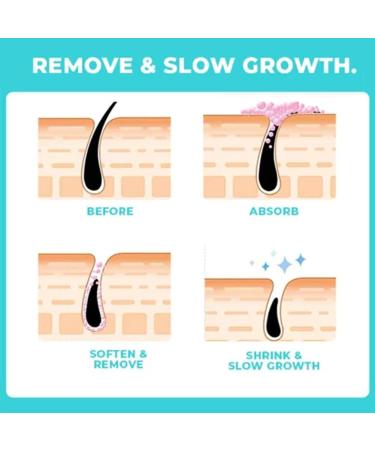 Magic Moisturizing Hair Removal Cream - Painless Upper Lip & Facial Mustache Treatment | Worldwide Shipping - Buy Online on SooperMarket.com