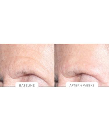 Age Reverse System - Rejuvenate Your Skin & Reverse Aging | Shop Internationally - Buy Online on SooperMarket.com