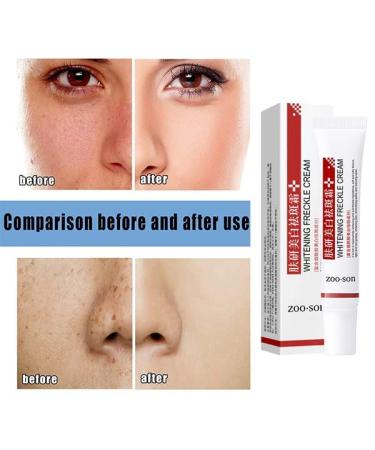 Xing Chen Hai Yang 3Pcs Spot Off Freckle Whitening Cream - Brighten Skin and Fade Freckles - Buy Online on SooperMarket.com
