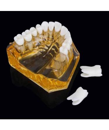 LBYLYH Adult Tooth Replica Model - Medical Dental Teaching Tool for Professionals - International Shipping Available - Buy Online on SooperMarket.com