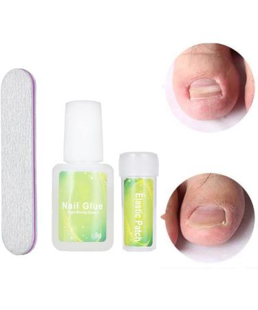 Ingrown Toenail Correction Kit Elastic Toe Nail Straightener Patch with Nail File Glue - Buy Online on SooperMarket.com
