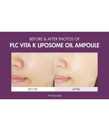 Leegeehaam PLC Vitamin K Liposome Oil Ampoule - Toning, Glowing, Hydrating Serum for Brighter Skin | Dr.Ceuracle - Buy Online on SooperMarket.com