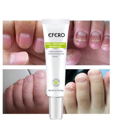 efero Nail Treatment Repair Gel - 2pcs | Nail Growth & Care Gel for Damaged Nails - Buy Online on SooperMarket.com