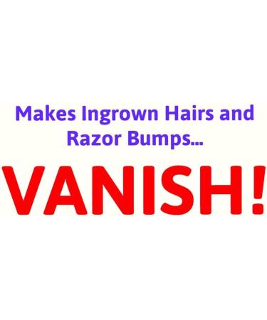 V22 MAX Double Strength Ingrown Hair Treatment Cream - Paraben and Cruelty Free - 50ml - Buy Online on SooperMarket.com