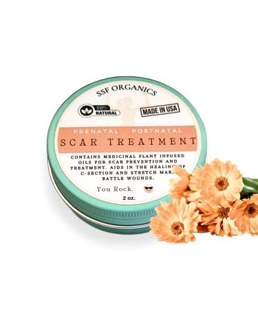 SSF Organics Scar Treatment for Stretch Marks C-Section Recovery Must Haves - Deeply Moisturize with Calendula Castor Shea - Advanced Scar Treatment for Mama Related Wounds