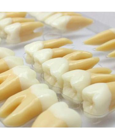 BEAGHTY 2.5x Magnified Tooth Shape Model - 2-Color Dental Structure & Denture Model for Study & Teaching - Buy Online on SooperMarket.com