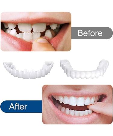 Buy Uqlpxz 2 Pairs Provisional Dental Prosthesis - Affordable Dentures & Cosmetic Teeth for Women & Men - Temporary Veneers & Artificial Teeth - Buy Online on SooperMarket.com