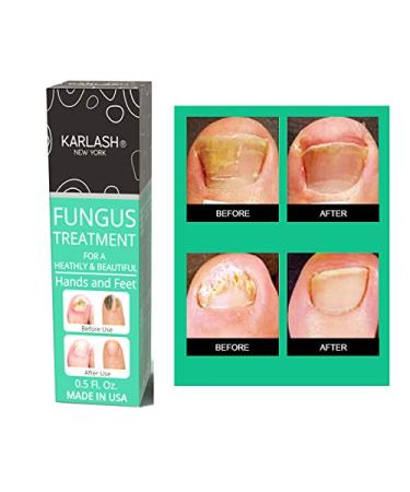 Karlash Extra Strong Nail Fungus Treatment Kit - Made in USA - 0.5oz - For Nails and Toes - Buy Online on SooperMarket.com