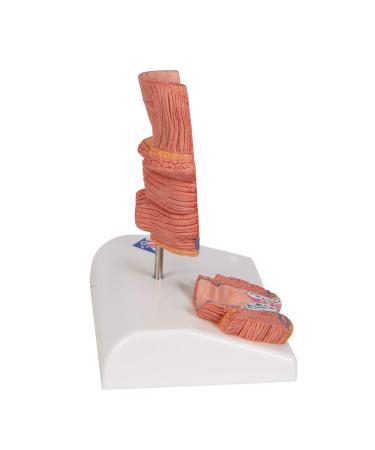 3B Scientific K27 Hemorrhoid Model 5.5-Inchx3.9-Inchx5.5-Inch - Buy Online on SooperMarket.com