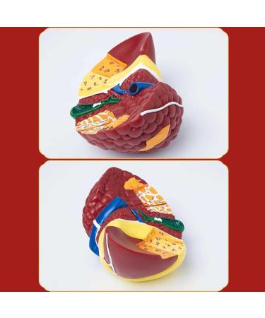Teaching Model Human Liver Educational Model with Base and Clear Texture and Pathological Features Liver Cirrhosis Model for Medical School Study and Research - Buy Online on SooperMarket.com