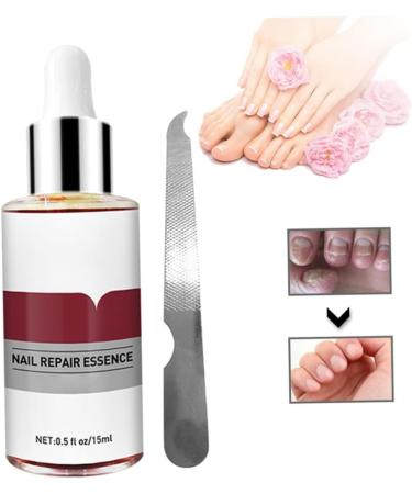 1PC Nail Treatment Nail Renewal Solution Toenails & Fingernails Nail Repairs Essential Oil Protects Toenail Fungus Treatment From Discoloration Brittle And Cracked Nail(12ML) - Buy Online on SooperMarket.com