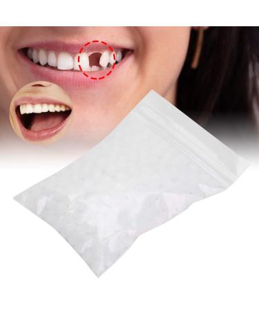Temporary Tooth Repair Beads - 10g Filling Material for Missing/Broken Teeth - Replacement Kit - Buy Online on SooperMarket.com