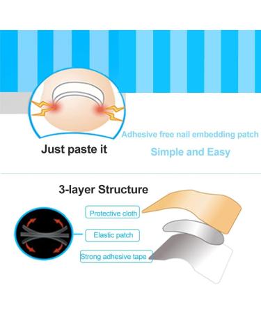 Ingrown Toenail Correction Patch Ingrown Correction Sticker 46 Pieces Ingrown Toenail Correction Patch Care Ingrown Nail Patch for Men Women - Buy Online on SooperMarket.com