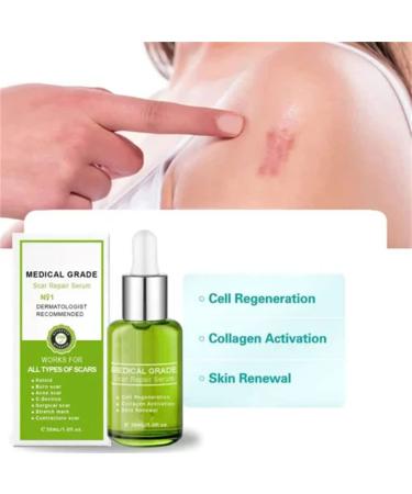 Goopgen Advanced Scar Repair Serum 30ML - Nature Scar Treatment - Scar Removal Serum for All Types of Scars (1PC) - Buy Online on SooperMarket.com