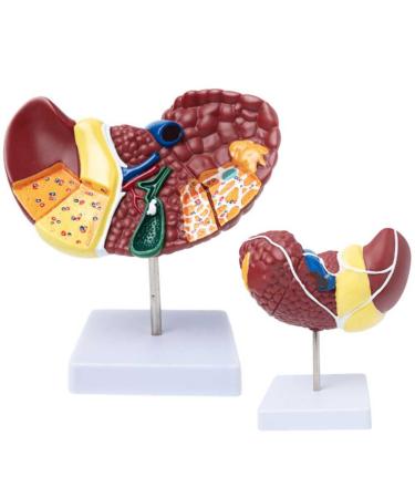 Teaching Model Human Liver Educational Model with Base and Clear Texture and Pathological Features Liver Cirrhosis Model for Medical School Study and Research