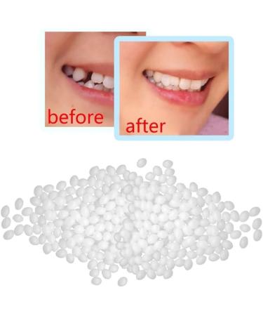ChezMax Temporary Tooth Repair Kit - Fix Missing & Broken Teeth - Natural Solution - Buy Online on SooperMarket.com